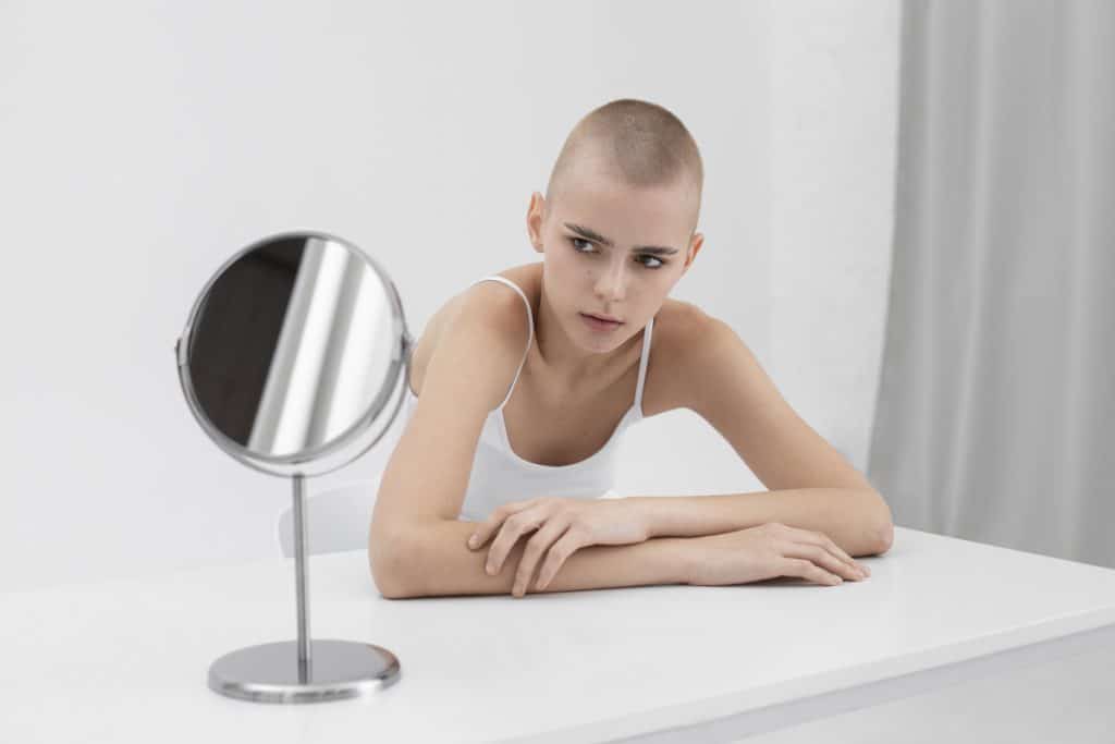 Ritlecitinib: primeiro remédio para alopecia areata em adolescentes
